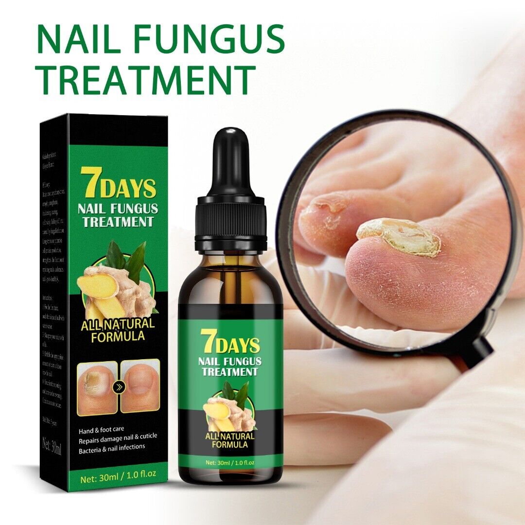 Ginger Nail Fungus Treatment Anti Fungal Foot Toenail Care Removal Repair Liquid